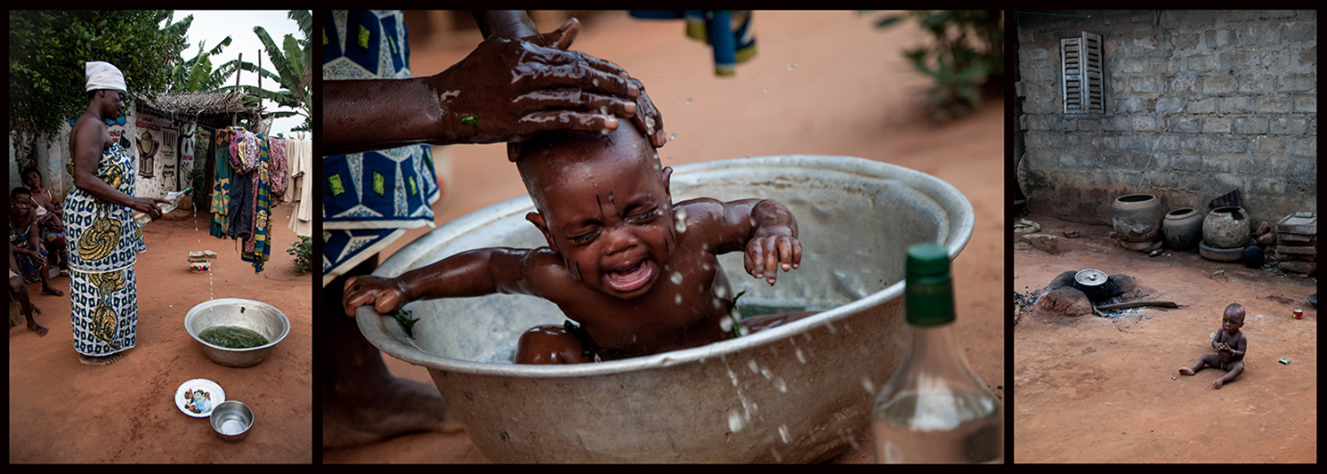 Dans une bassine à moitié remplie d’eau, Gamba Dahoui verse du gin, avant d’y écraser des feuilles d’isope et de moringa. C’est là que les nouveaux initiés laveront leurs blessures, sous le regard effaré d’un des enfants du quartier. Selon la ministre de la santé du Bénin, Dorothée Kinde Gazar, les cas d’infections liées à la scarification rituelle sont très rares. “Nos tradi-thérapeutes ont des plantes qui servent non seulement d’antibiotique, d’antiseptique, et d’anti-inflammatoire.”