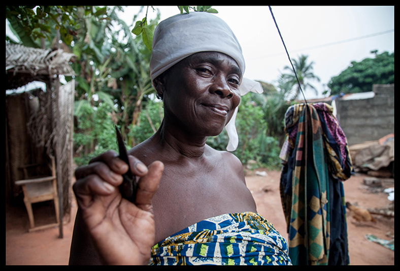 Gamba Dahoui est très fière de sa fonction. C’est toujours la même lame, chargée d’une dimension mystique, qui est utilisée pour la scarification. “Je ne la fais pas bouillir, je la nettoie seulement avec de l’huile rouge. ” Depuis des années les institutions sanitaires du pays font de la sensibilisation pour que les 