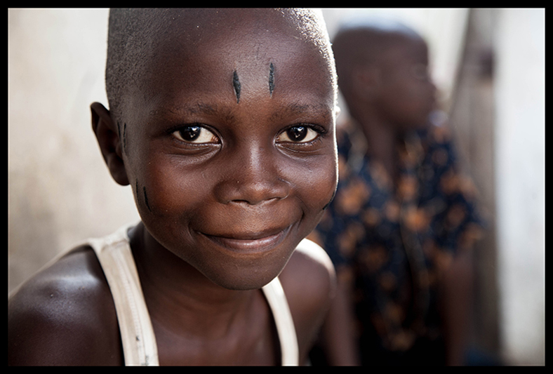 Une semaine plus tard, les plaies ont bien cicatrisé. Geneviève continue d'y appliquer du charbon après chaque toilette, pour ses vertus cicatrisantes. Luc et Hospice ont repris l’école. “Mes camarades m’ont demandé si ça fait mal. J’ai répondu que non. Ils m'ont demandé si j’ai pleuré, et j ai dit que non”, fanfaronne Luc. “Je suis content d’avoir ça. Avant quand je sortais avec mon grand-frère, qui a les marques, les gens ne croyaient pas que c'était mon frère. Ils disaient 