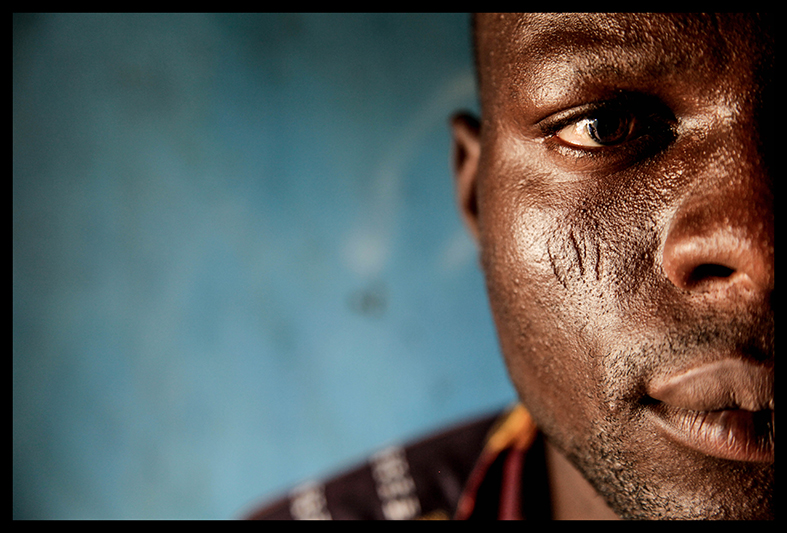 Michael Guédézoumé, de la ville de Bohicon, a reçu ses cicatrices en hommage à son aïeul. Il envisage de les transmettre à ses enfants quand il en aura, même si “de nos jours, le monde change. Certains se disent que si ils font ça à leur enfant, il deviendra vilain. Et puis l’église aussi est venue neutraliser la tradition. C’est pour ça que les gens se disent “on a pas besoin de ça…”